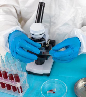 Laboratuvardaki kanı incele. Seçici odaklanma. ilaç.