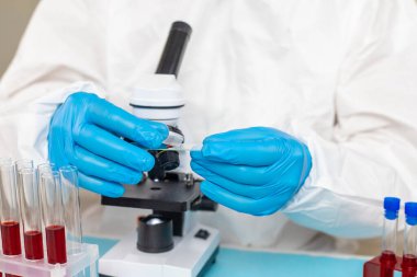 Laboratuvardaki kanı incele. Seçici odaklanma. ilaç.