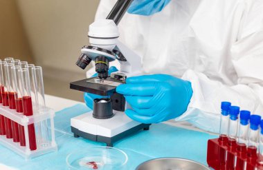 Laboratuvardaki kanı incele. Seçici odaklanma. ilaç.