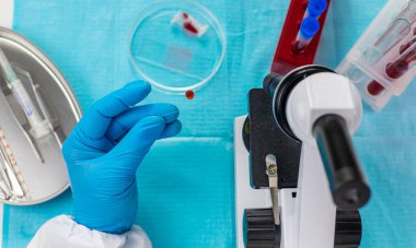 Laboratuvardaki kanı incele. Seçici odaklanma. ilaç.