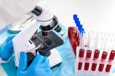 Laboratuvardaki kanı incele. Seçici odaklanma. ilaç.