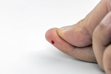 Penisten küçük bir damla kan damlayan parmağın yakın plan görüntüsü, beyaz arka plan üzerine kurulmuş, tıbbi veya sağlıkla ilgili konsepti gösteriyor.