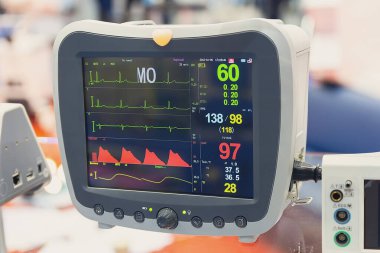 Hastane tiyatrosunda kalp atış hızı monitörü. Hastanedeki hayati belirtileri anestezi ameliyatından izlemek için tıbbi cihaz. EKG hasta monitörü. tıbbi elektronik.