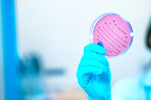 실험실 직원들은 미디어에서 배양하는 박테리아나 바이러스가 접시를 실험용 안경에 담는다 — 스톡 사진