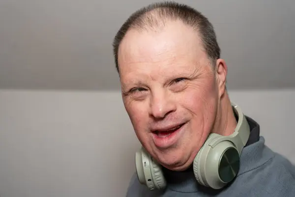 50 yaşında, yetişkin, Down sendromlu, mutlu bir geçmişi var.