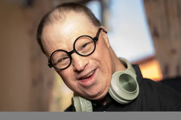 50 yaşında, Down sendromlu. Çok etkileyici.