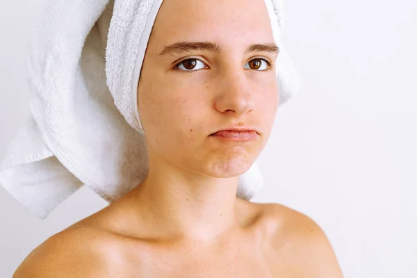 Teen girl with teenage acne on face, with bath towel on hair, with sad expression. gloomy upset girl, brown eyes, emotion of discontent and despair on face. Teen skin care concept, problem skin on light background