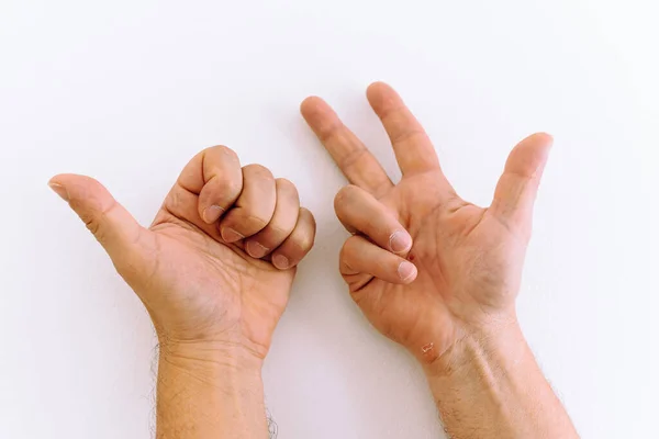 Male hands, with callused palms, showing fingers, against white wall