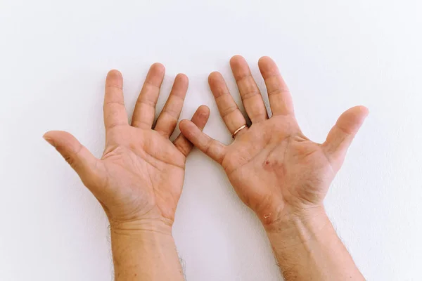 Male hands, with callused palms, showing fingers, against white wall