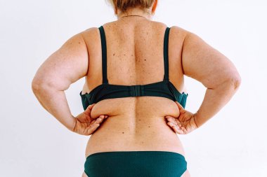 Yaşla ilgili deri değişimleri, sarkmalar, yaş noktaları, obezite, cilt gevşekliği gösteren tanınmayan orta yaşlı bir kadın. konsept sağlıksız gıda, düzeltme, diyet, spor