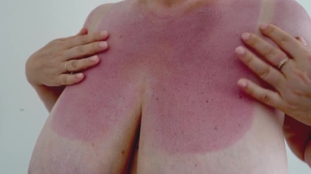 日焼けした赤い胸の肌に太陽のボディローションの後の保湿を適用する彼女の50代の裸の美しい女性の正面図 乾燥肌の繊細なケア製品のコンセプトに抗う日焼け治療 — ストック動画
