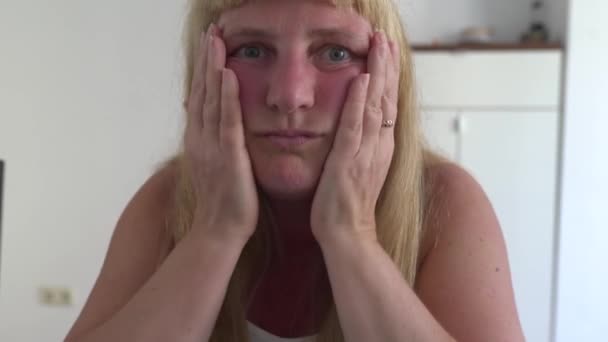 Žena Středního Věku Blondýna Baculatá Dotýká Zarudlé Tváře Oteklá Alergií — Stock video