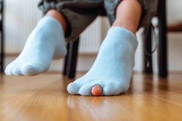 Hole Blue Sock Shows Woman Middle Finger — Stock Photo, Image