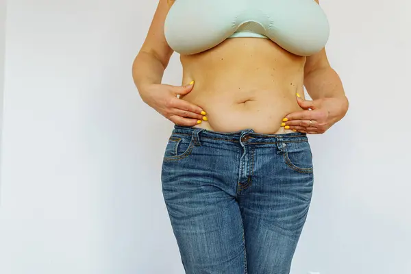 Overweight woman, wearing bra and jeans, showing fat exposed big belly with navel. Hanging, big belly. Go on diet, liposuction. Fat burning treatment of thick belly. Weight loss program, dieting.