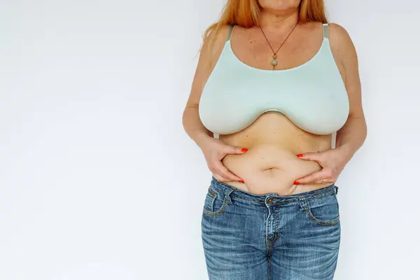 Overweight woman, wearing bra and jeans, showing fat exposed big belly with navel. Hanging, big belly. Go on diet, liposuction. Fat burning treatment of thick belly. Weight loss program, dieting.