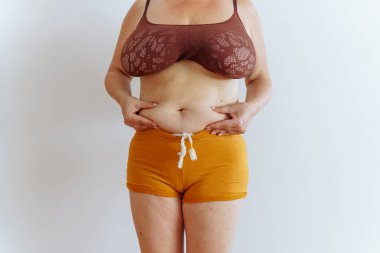 Sarı şortlu ve bluzlu tanınmayan bir kadın, sarkık derili şişman göbek, kilo kaybı, diyet, sağlıksız diyet, yağ aldırma, vücut pozitifliği