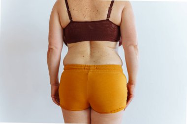 Sarı şortlu ve bluzlu tanınmayan bir kadın sarkık derili, kilo verme konsepti, diyet, sağlıksız beslenme, yağ aldırma, vücut pozitifliği