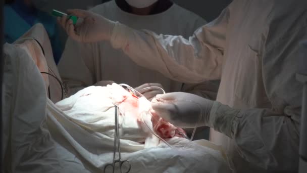 키예프 우크라이나 2022 의사들은 수술실에서 수술을 있습니다 — 비디오