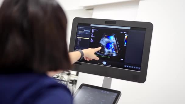 Video Der Rückansicht Eines Kardiologen Der Den Bildschirm Mit Einem — Stockvideo
