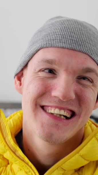 Portrait Happy Smile Man Cerebral Palsy Sitting Wheelchair — Stok Video