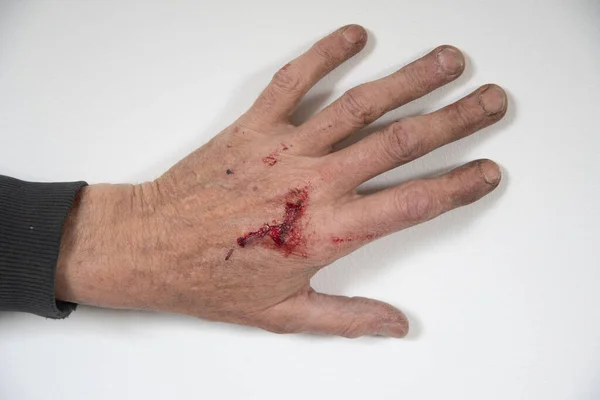 Bloody Dirty Left Hand Working Man Back Male Worker Wound — Stock Photo, Image