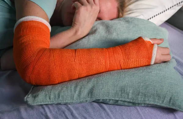 woman with a broken right arm with an orange fiberglass plaster cast sleeps in bed with a pillow under the cast, everyday life with trauma, High quality photo