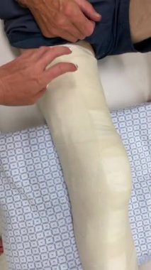 Kadın kocasının bacağının yeni alçısının gücünü kontrol ediyor. Kanepede bacağı kırık bir adam. Yüksek kalite 4K görüntü.