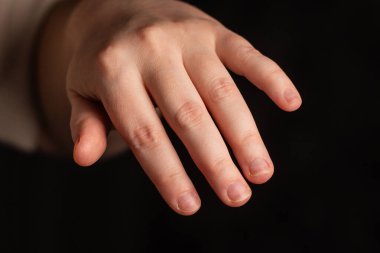 Parmak ve tırnak yemenin yakın plan görüntüsü. Sağlık ve tıbbi konsept. Manikür sanatçısı. Öncesi ve sonrası için resim.