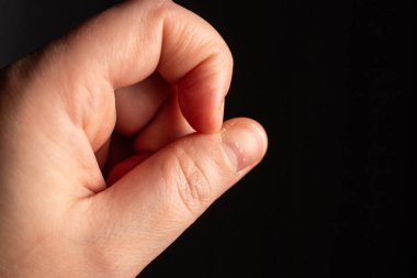 Tırnak karıştıran stresli bir kadın. Anksiyete ve akıl sağlığı bozukluğu var. Çirkin çivilerin resmini kapat.