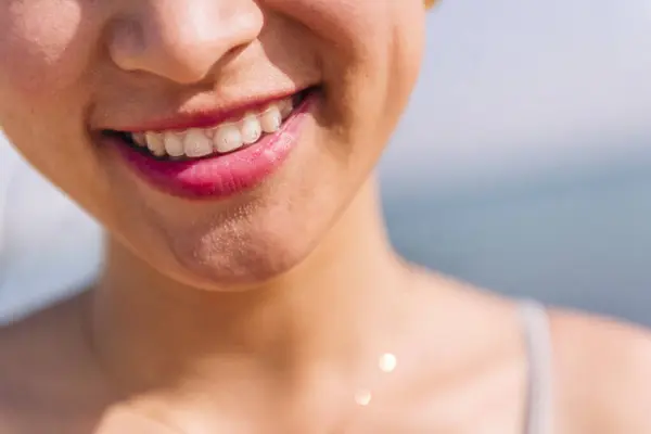 Zblízka Úst Krásné Ženy Neviditelnými Rovnátka Úsměvem Šťastný Zubní Zdraví Stock Obrázky
