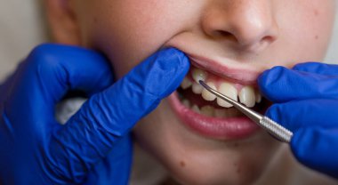 Diş hekiminde dişlerini gösteren bir çocuğun ağzı açık.