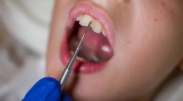 Diş hekiminde dişlerini gösteren bir çocuğun ağzı açık.