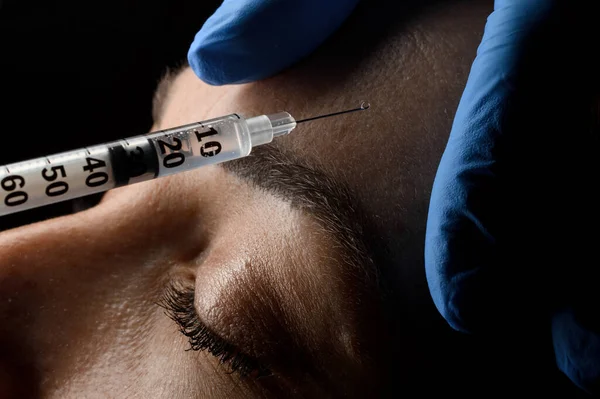 Close-up of caucasian female forehead and a syringe with a needle making an injection of botox in the skin.