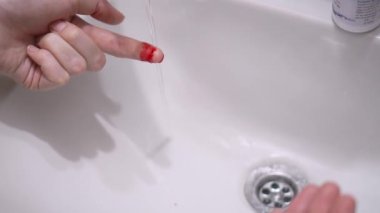Hand with blood clean under running tap in sink. Bloody finger of white man's hand in sink in bathroom, washed with clean running water so as not to bring infection