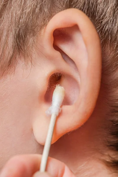 Cleaning the ear with a cotton swab. The process of cleaning the ears close-up, yellow cotton swab with dirt from the ear. Mother cleaning babys ear, with copy space.