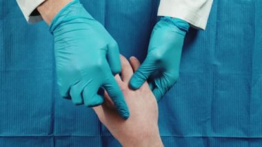 Hands of a patient from a dermatologist doctor in the outpatient clinic