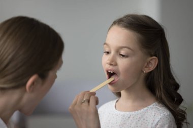 KBB doktoru klinikteki küçük kızın boğazını muayene ediyor. Kapatın. Çocuk doktorunun elinde ahşap spatula dil basacağı var. İltihaplı bademcikleri inceliyor, profesyonel tıbbi yardım sağlıyor.