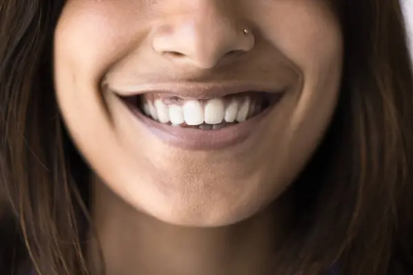Неприємна Посмішка Крупним Планом Щасливої Молодої Індійської Жінки Нижнє Обличчя — стокове фото
