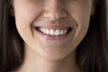 Aşağı yüz ve genç beyaz bir kadının dişlek gülümsemesi. Diş hekimliği kliniğinin, stomatolojiyi, dişçi hizmetini, diş bakımını destekleyen güzel, sağlıklı beyaz dişleri.