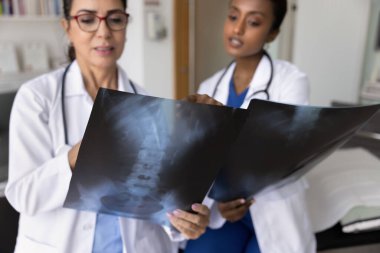 Kıdemli kadın doktor, genç Afrikalı bayan meslektaşıyla röntgen görüntülerini yakından incelerken görüşlerini paylaşıyor. Tarama sonuçlarını inceleyen tıbbi ekip, hasta tedavi planını tartışır ya da daha fazla ameliyat