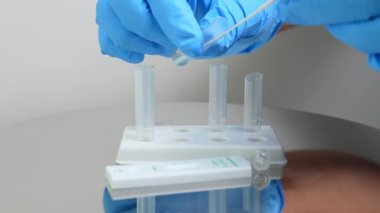 Mavi eldivenli şahıs evde COVID-19 hızlı test yapar. Sadece tüp bebek testlerinde kullanılır..