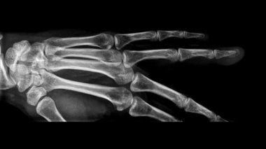 X ışını insan el taraması animasyon döngüsü, insan kemiklerinin monokrom x ışını görüntülemesi. Tarama görüntüsünü anatomik detaylarla durdur. İnsan el eklemlerinin kusursuz döngü animasyonu