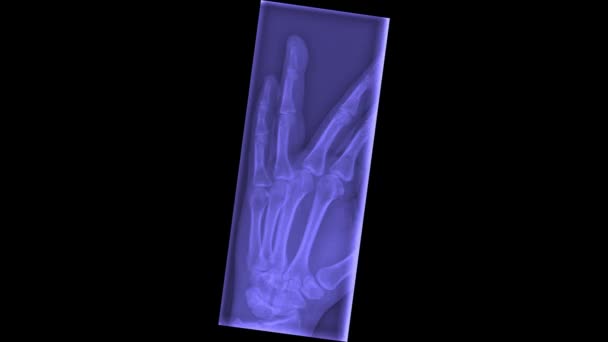 人間の手のひらをスキャンしたX線のアニメーションループ 人間の骨のモノクロX線画像のタイムラプス 解剖学的な詳細でスキャンの動きを停止します 人間の手関節のシームレスなループアニメーション — ストック動画