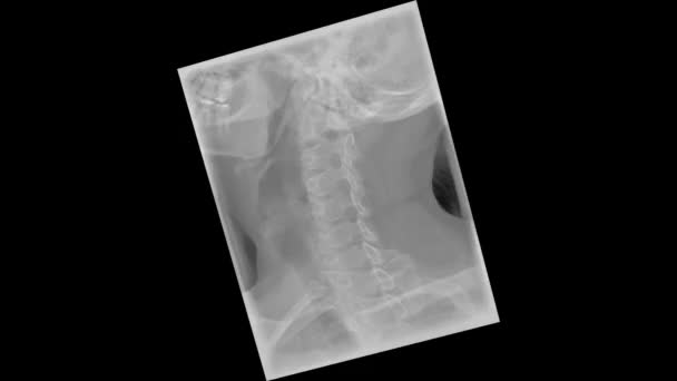 Mri 세트의 어깨의 부분의 이미징 해부학적인 세부사항을 검사의 전망을 멈추십시오 — 비디오