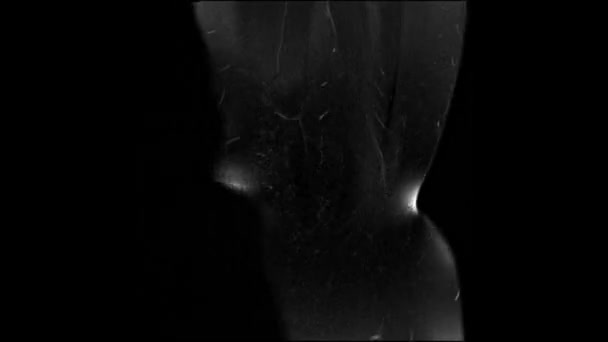 Проміжок Часу Мрт Сканування Людського Тіла Часовий Проміжок Монохромної Магнітно — стокове відео