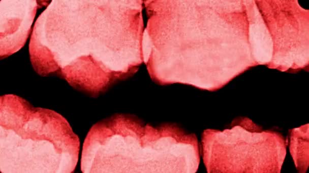 人間の歯X線またはCtスキャンホラーコレクションの動きを停止します 顎の赤い体の部分 血まみれの歯 怖いハロウィーンの背景 — ストック動画