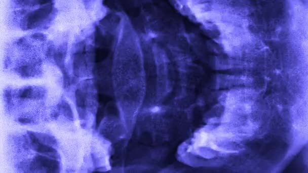 Stoppbewegungen Von Körperteilen Oder Röntgenaufnahmen Wirbelsäulenrippen Horrorsammlung Menschlicher Schädelkiefer Zähne — Stockvideo