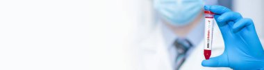 Doctor holding a test blood sample tube positive with ?ovid-19 XBB.1.5 Kraken Variant variant or strain COVID-19.Banner