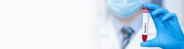 Doktor, hepatit C virüsü (HCV) olan bir test tüpü tutuyor. Banner. Metin için alanı kopyala