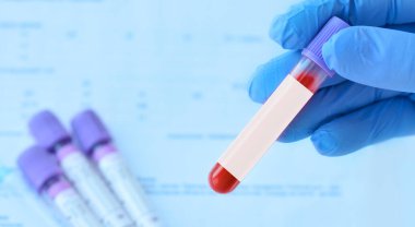 Hand with medical glove of Lab worker holds test tube with blood sample and blank label for own text on the background of medical test tubes.